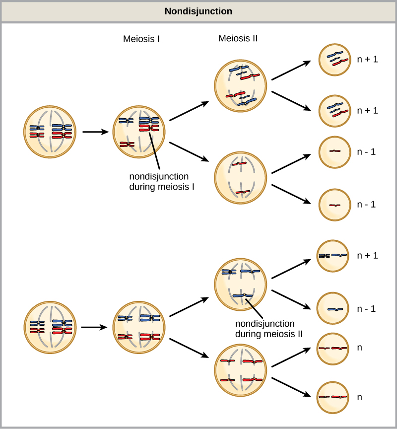This illustration shows nondisjunction during meiosis I and meiosis II. Nondisjunction during meiosis I occurs when a homologous pair fails to separate, and results in two gametes with n + 1 chromosomes, and two gametes with n – 1 chromosomes. Nondisjunction during meiosis II occurs when sister chromatids fail to separate, and results in one gamete with n + 1 chromosomes, one gamete with n – 1 chromosomes, and two normal gametes.