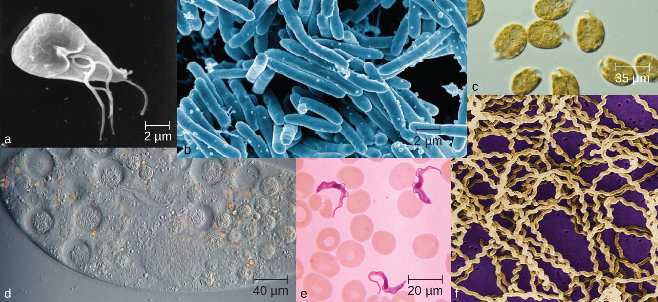 Photos of various mirobes. A) a triangular cell approximately 10 µm long with long flagella. B) Many rod shaped cells approximately 10 µm long. C) Round cells approximately 85 µm in diameter. D) a portion of a large oval over 200 µm in length with smaller spherical structures inside. E) Long, ribbon shaped cells approximately 20 µm in length. F) Many long spiral cells.