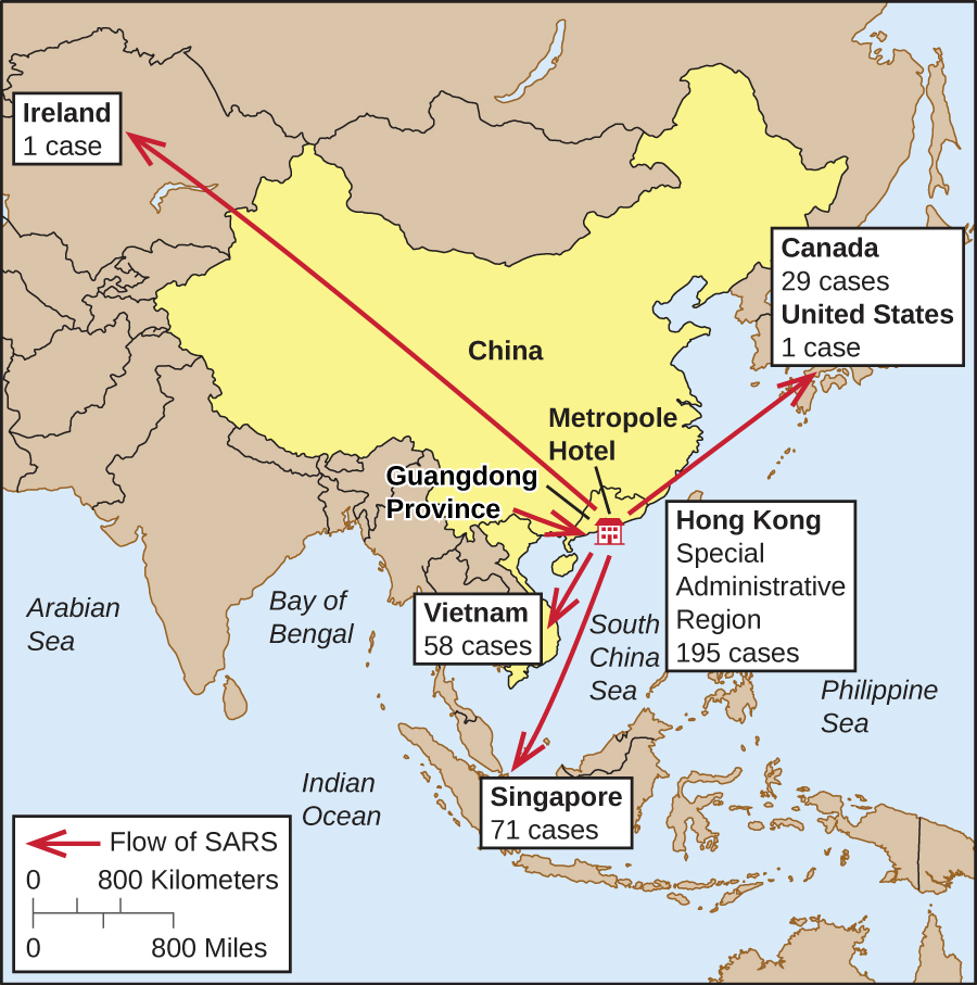 A map showing the spread of SARS. It began in the Metropole hotel in Guangdong province in China It then spread to Vietnam (58 cases), Singapore (71 cases); Hong Kong (special administrative region 195 cases), Canada (29 cases), United States (1 case); and Ireland (1 case).